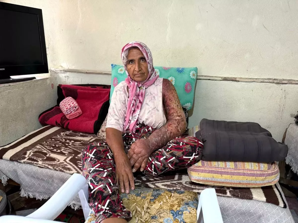 Adana'da 4 Çocuk Annesinin Tedavi Umudu
