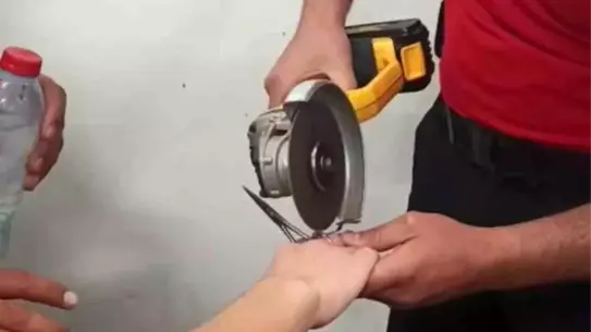 Tarsus'ta Çocuk Makas Halkasından Kurtarıldı