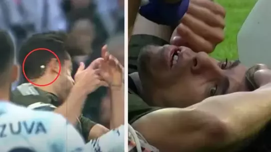 Beşiktaş'ta üst üste şanssızlıklar! 2 sakatlık, bir de dişi kırılan futbolcu
