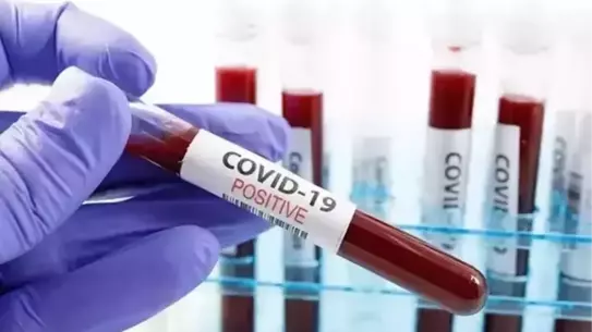 COVID-19 Nedeniyle Haftalık Ölümler 300'ü Aşıyor