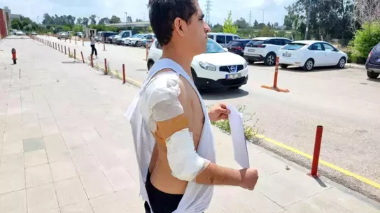Adana'da Kurt Köpeği Saldırısı