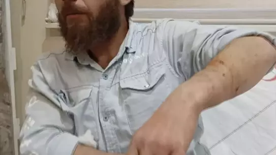 Adıyaman'da Köpek Saldırısı: Bir Kişi Yaralandı