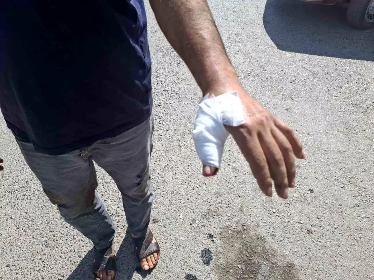 Kahramanmaraş'ta Bayramda Acemi Kasaplar Hastaneye Koştu