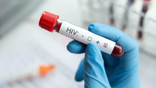HIV tedavisinde devrim niteliğinde adım! Yeni yöntem geliştirildi