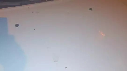 Boşanma Sürecinde Şiddetli Saldırı